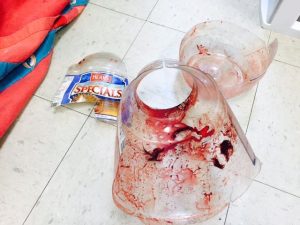 Pictured: Jug removed from Winnie's head (Via Doc Williams SPCA)